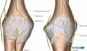 Osteoarthritis