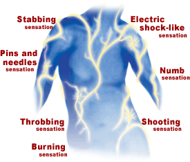 Muscle Pain & Nerve Pain